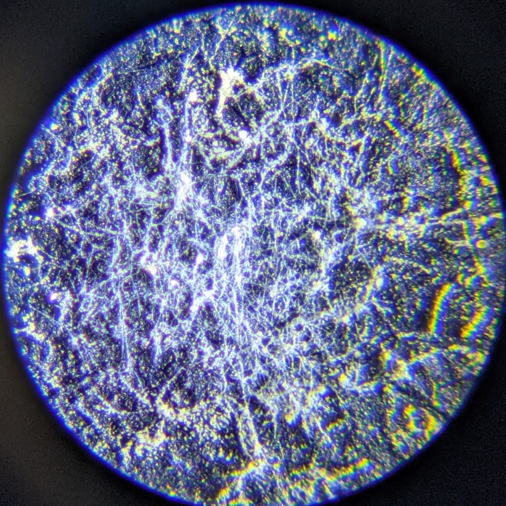 Detail of mold spore under magnification.