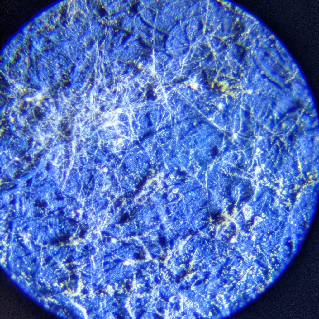 Detail of mold spore under magnification.
